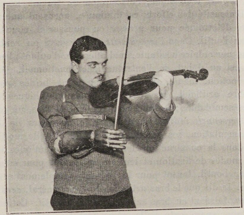 A man wearing a sweater and a prosthetic arm plays the violin. He has dark hair and a focused expression.