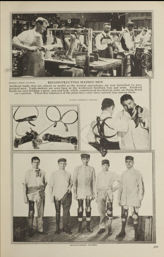 Workers fitting artificial limbs in a workshop, with men wearing prosthetics.