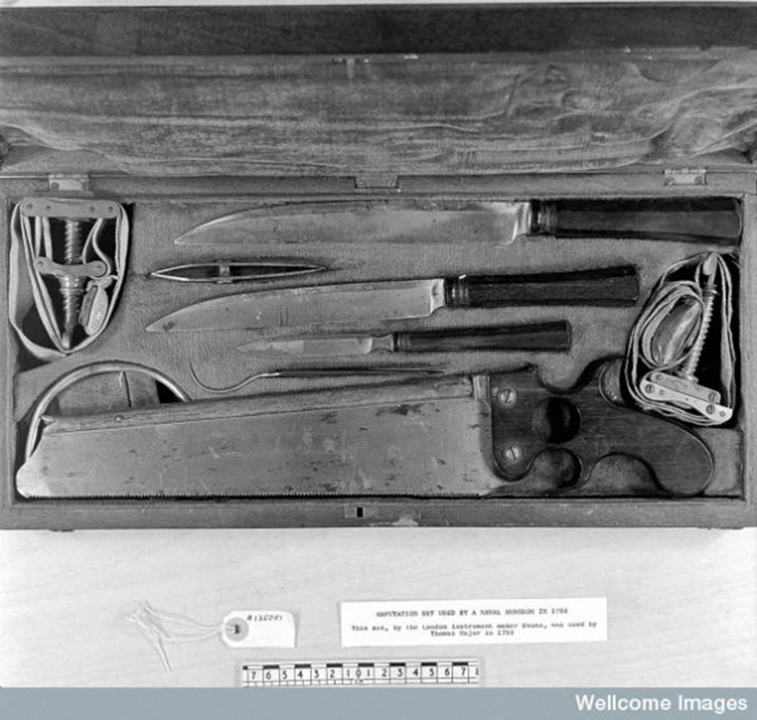 Leg off Image 1